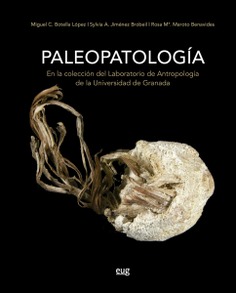 Paleopatología en la colección del laboratorio de Antropología de la Universidad de Granada